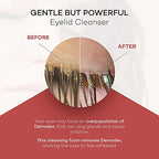 Zocular ZocuFoam foaming pump bottle for daily eyelid hygiene