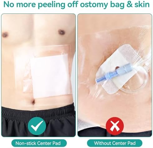 Lefeke 14 count pack of stoma shower shields for colostomy care