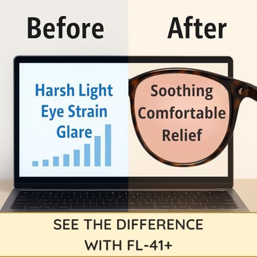Angle view of tortoise shell frame for light sensitivity