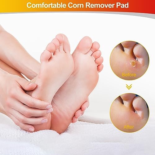 Full 24 pack contents of the MYMULIKE foot and callus treatment kit.