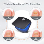 Top view of B-Arm laser treatment tool for discolored and damaged nails.