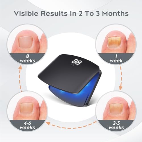 Top view of B-Arm laser treatment tool for discolored and damaged nails.