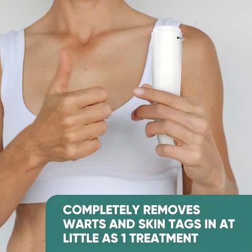 At-home cryotherapy treatment for skin tag removal on underarms.