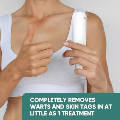 At-home cryotherapy treatment for skin tag removal on underarms.