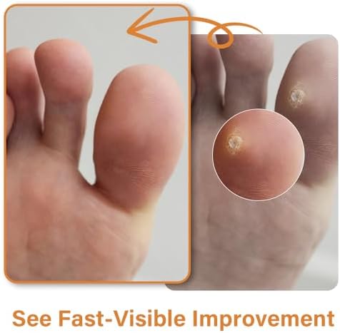 AEE foot care patches package instructions for safe hard skin shedding