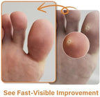 AEE foot care patches package instructions for safe hard skin shedding