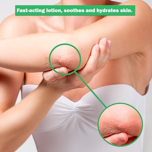 Dr. Dan's 2.5 ounce hydrocortisone lotion for skin inflammation and redness