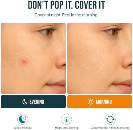 Waterproof hydrocolloid patch bandages being applied to skin to demonstrate flexible adhesion