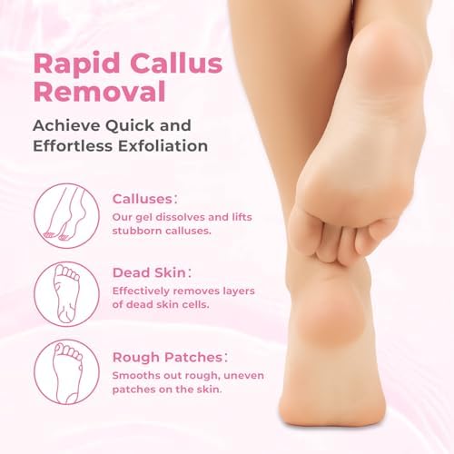 Professional foot callus remover kit showing the gel bottle and stainless steel foot file.