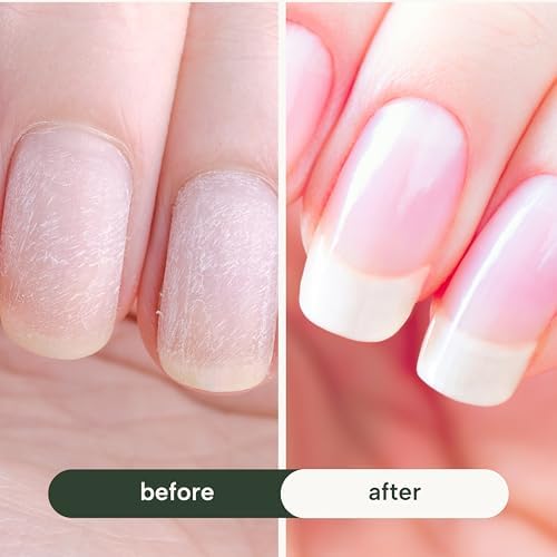 Clear nail growth serum providing assistance with peeling and splitting prevention