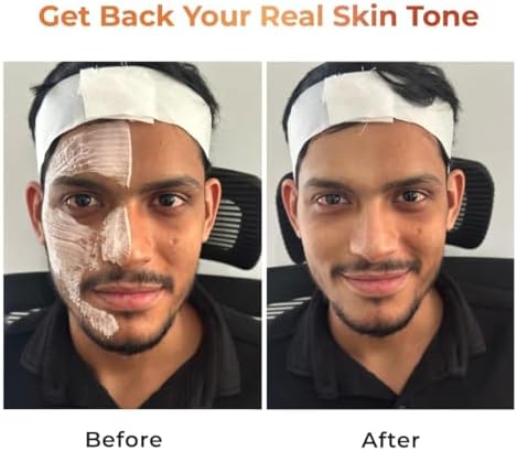 Applying Niconi Gluta-Kojic skin polish on hand