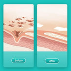 Hydrating hydrogel wound dressing for autolytic debridement and necrotic tissue removal.