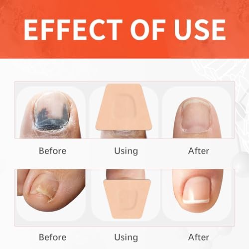 Authentic USA imported Johnson's Foot nail treatment patches for Indian customers.