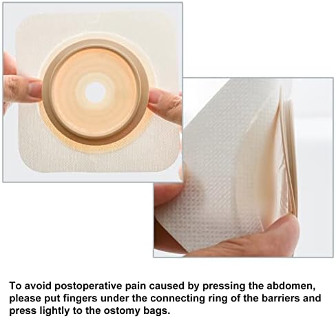 VLOOKUP ileostomy stoma care kit contents including fifteen bags and six barriers packaging layout