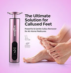 Professional foot file with replaceable sandpaper discs for dead skin removal.
