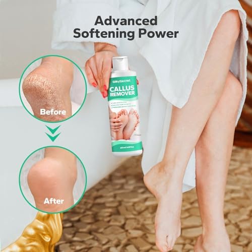 Extra strength foot gel for cracked heel treatment and exfoliation