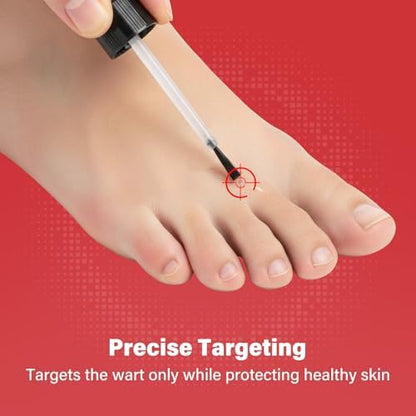Applying Goodnites liquid wart remover to affected foot area.