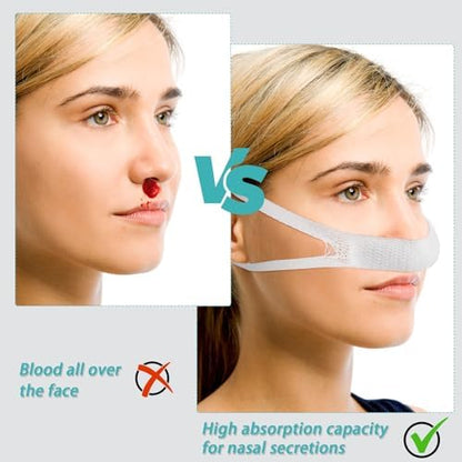 Bulk pack of 30 Patelai nasal bandages for rhinoplasty and septoplasty recovery