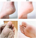 User holding natural pumice stone for heel care