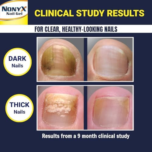 Authentic Nonyx USA imported nail gel for thick and brittle toenails