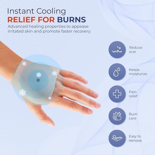 BurnFix burn cream being applied to a minor burn for instant cooling effect.