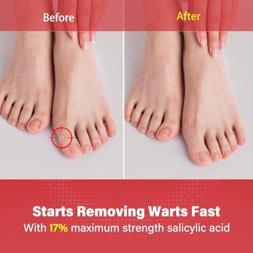 Goodnites USA imported skincare treatment for corns and calluses.