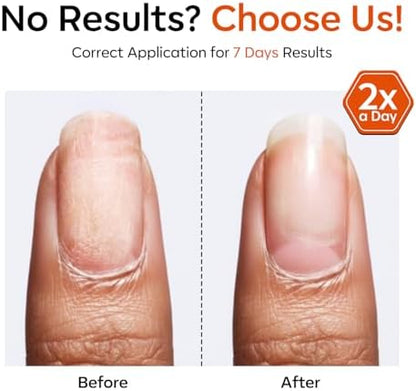 Side profile of Modelones nail repair treatment bottle
