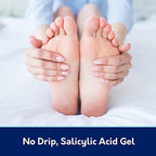 Compound W wart remover gel texture showing clear fast-drying formula.