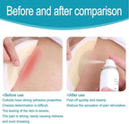 Compact adhesive remover spray for travel and mastectomy care.