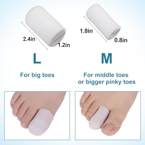 Toe protectors being worn on a foot to show placement and fit.