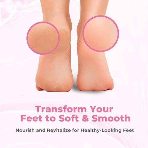 SAISZE callus remover gel being applied to a heel using the integrated brush head.