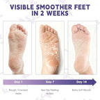 Devyonder lavender foot mask pairs opened