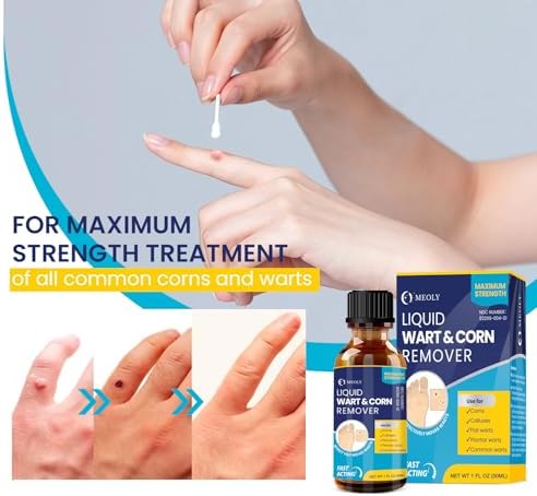 MEOLY skin treatment liquid for plantar warts and calluses on feet.