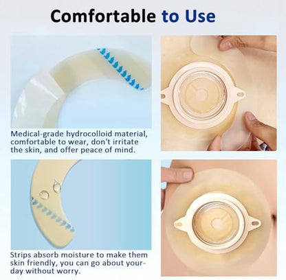 Hypoallergenic ostomy wafer extenders for active lifestyle skin protection close up