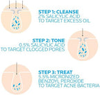 Dermatologist tested acne skincare kit safe for sensitive reactive skin