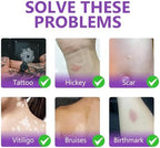 Pluservice Kylvo tattoo cover up concealer applied on arm covering a tattoo