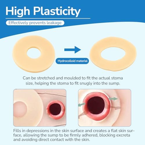Flexible skin barrier rings for colostomy bags being stretched by hand