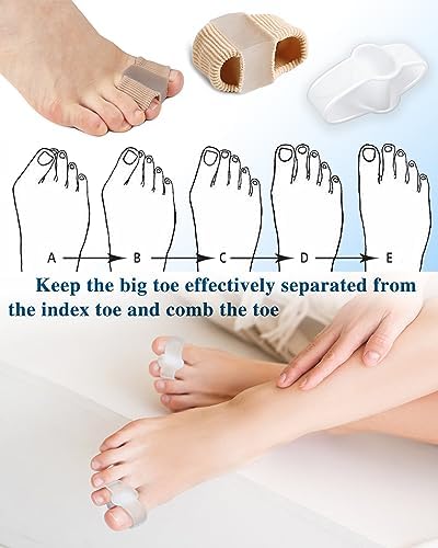 Side view of PGRODE hammer toe spacers demonstrating the 0.5 inch gap creation.