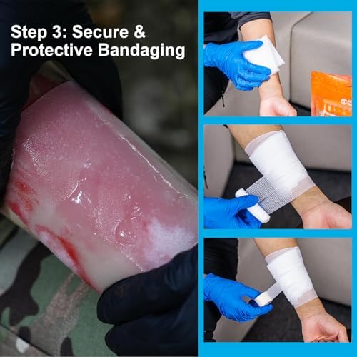 Portable burn care kit for home and outdoor safety