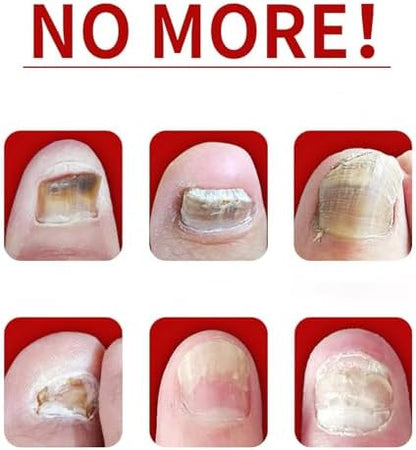 Natural botanical nail treatment providing assistance with restoring damaged nail plates