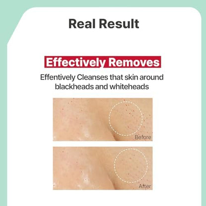 Applying Illiyoon cleansing oil to face
