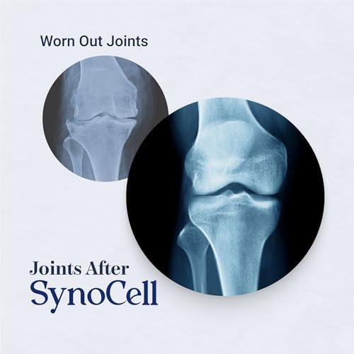 Glucosamine Chondroitin Complex Back, Neck, and Joint Support Supplement with Boswellia, Quercetin, & MSM - Renew Your Joints from The Inside Out - Move with Freedom and Ease - Image 3