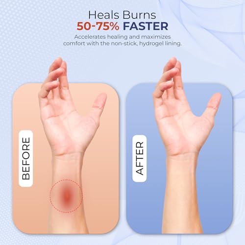 Close up of BurnFix packaging highlighting Heat Sinking Technology for pain relief.