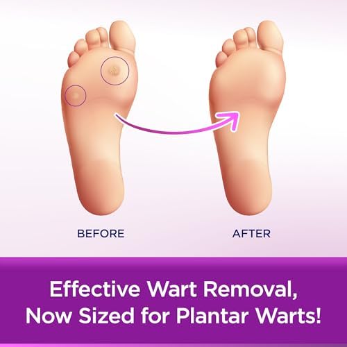 WartStick Plantar medicine label showing 40 percent salicylic acid active ingredient.