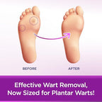 WartStick Plantar medicine label showing 40 percent salicylic acid active ingredient.
