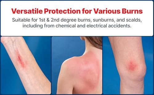 Authentic USA imported Burn-Fix emergency burn care spray for Indian households.