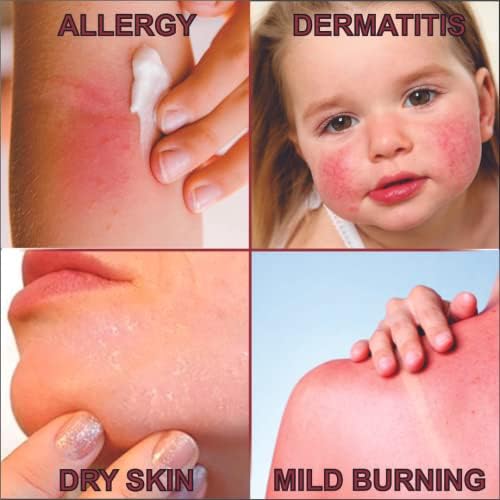 Quatriderm NF extra strength skin rash treatment 2 ounce packaging
