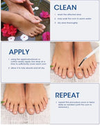 Authentic USA imported MYMULIKE liquid corn remedy for smooth feet