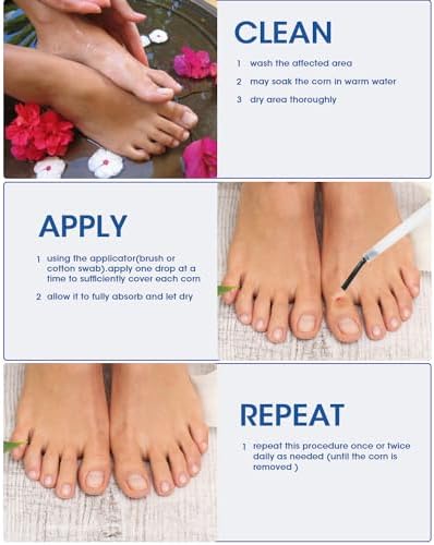 Authentic USA imported MYMULIKE liquid corn remedy for smooth feet