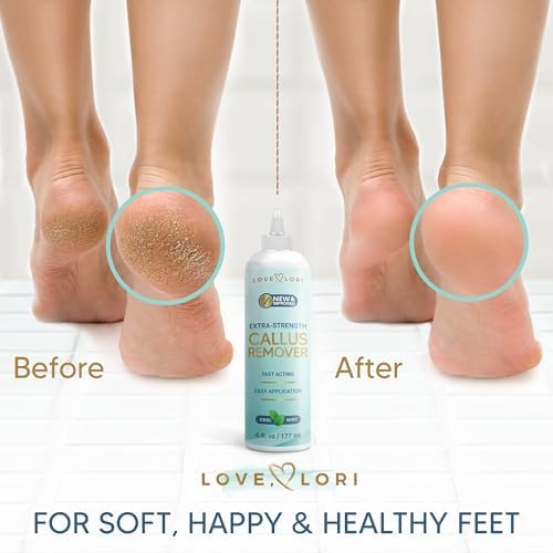 Foot care spa essentials gel for removing dead skin and cracked heels